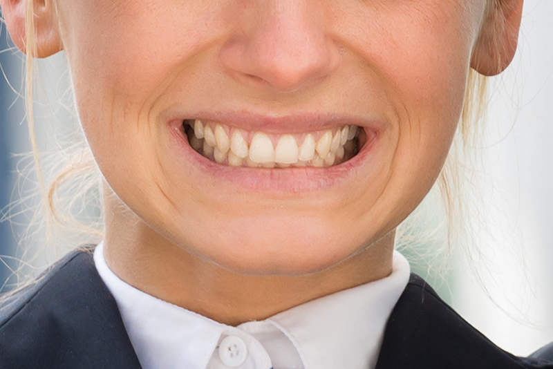 Woman's Teeth